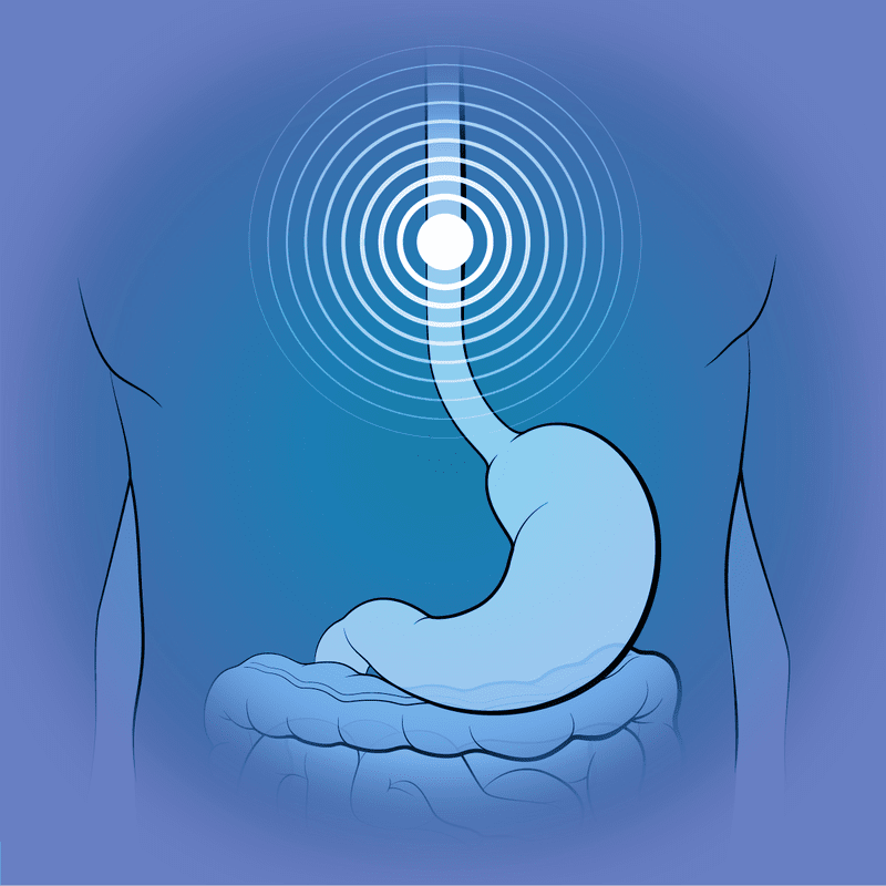 Esophageal symptoms (HIV Symptom Guide)
