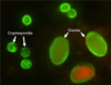 Oocysts of <em>Cryptosporidium parvum</em> (smaller ovals on left and top) and <em>Giardia intestinalis</em> (larger ovals and lower right) stained with immunofluorescent antibodies.