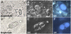 These stool sample wet mount tests show three wet mount techniques for diagnosing <em>Cystoisospora belli</em>: bright-field microscopy (A and D); differential interference contrast (DIC) (B and E); and blue UV fluorescence microscopy (C and F). The images on the top row (A, B,and C) show <em>C</em>. <em>belli</em> with a single internal sporoblast, and the images on the bottom row (C, D, and E) show two internal sporoblasts.