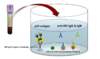 In this example, the patient sample contains HIV-1 p24 antigen and anti-HIV antibodies that bind to the HIV-1 p24 capture antibody and the HIV recombinant proteins.