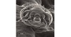 This scanning electron microscopy shows a scabies mite (<em>Sarcoptes scabiei</em> var. <em>hominis</em>) in a specimen obtained from the scraping of a woman's hand.