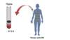 Conventional HIV drug resistance genotype testing requires obtaining a blood draw from a person with HIV, and the test is run on plasma.