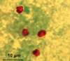 The stain shows multiple red, oval organisms that are 4-6 &micro;m in diameter.