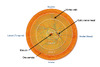 This illustration shows a schematic representation of an entire retina with superimposed anatomic zones (as defined by the UCLA CMV Retinopathy Study Group). Using a standard direct ophthalmologic examination, only a small portion of the retina is visualized (all of zone 1 and some of zone 2). Zone 1 comprises less than 10% of the entire retina.&nbsp;
