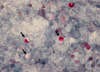 The black arrows point to multiple <em>Cryptosporidium</em> oocysts.