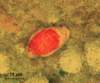 This modified acid-fast stain of a stool sample shows an <em>I. belli</em> sporoblast, which are typically 15 by 30 microns in size.